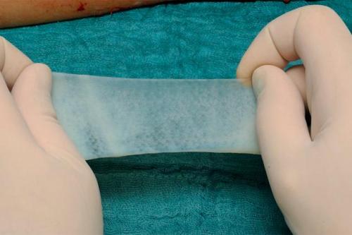 biodegradable-burn-membrane